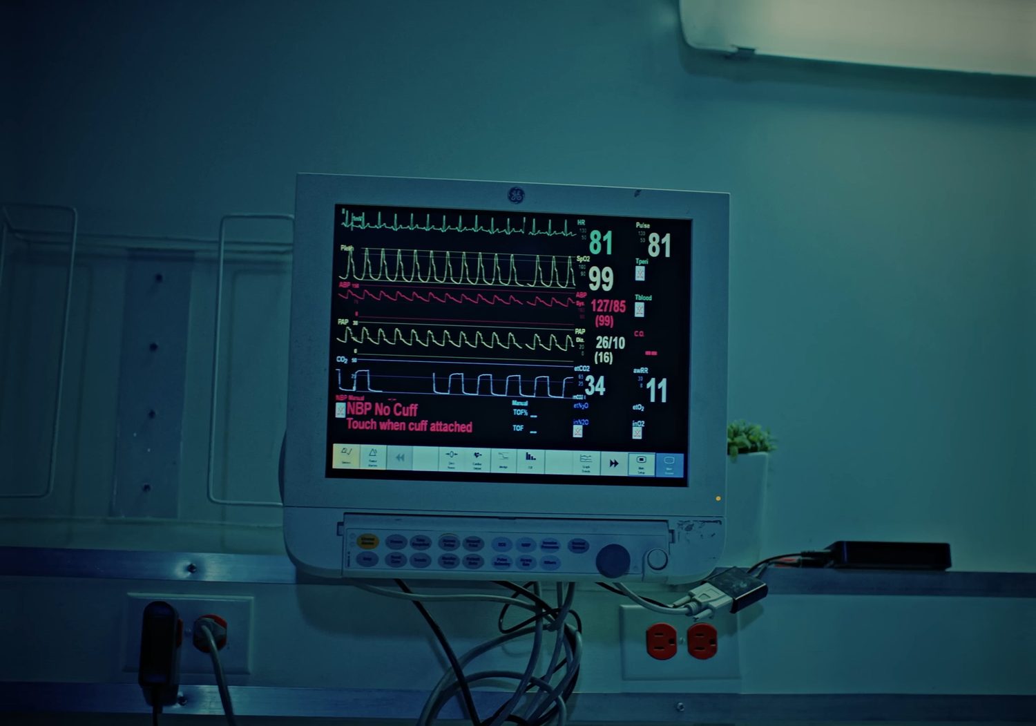 A bedside patient monitor on a blue-green hospital wall